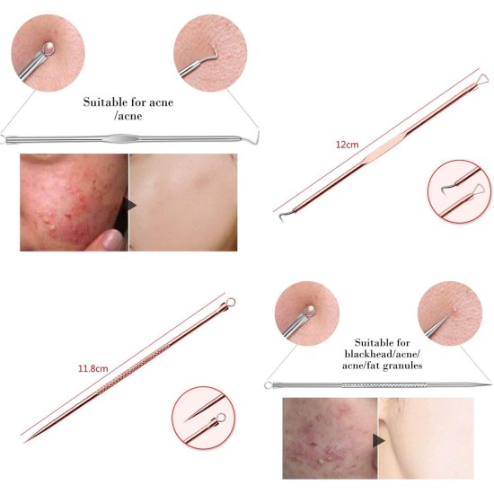 Blackhead Remover Pimple Comedone Extractor Tool Best Acne Removal Kit - Treatment for Blemish, Whitehead Popping, Zit Removing for Risk Free Nose Face Skin with Case (Rose, 4 Piece Set) Blackhead Remover Pimple Comedone Extractor Tool Best Acne Removal Kit - Treatment for Blemish, Whitehead Popping, Zit Removing for Risk Free Nose Face Skin with Case (Rose, 4 Piece Set)