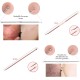 Blackhead Remover Pimple Comedone Extractor Tool Best Acne Removal Kit - Treatment for Blemish, Whitehead Popping, Zit Removing for Risk Free Nose Face Skin with Case (Rose, 4 Piece Set) Blackhead Remover Pimple Comedone Extractor Tool Best Acne Removal Kit - Treatment for Blemish, Whitehead Popping, Zit Removing for Risk Free Nose Face Skin with Case (Rose, 4 Piece Set)