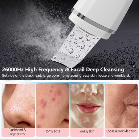 XinBarber Facial Skin Scrubber, Ultrasonic EMS Exfoliating Device Blackhead Remover Pore Cleaner Electric Skin Spatula Wrinkle Remover,Comedones Extractor for Facial Deep Cleansing,4 Modes,LCD Display XinBarber Facial Skin Scrubber, Ultrasonic EMS Exfoliating Device Blackhead Remover Pore Cleaner Electric Skin Spatula Wrinkle Remover,Comedones Extractor for Facial Deep Cleansing,4 Modes,LCD Display