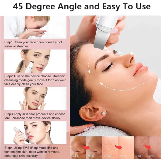 XinBarber Facial Skin Scrubber, Ultrasonic EMS Exfoliating Device Blackhead Remover Pore Cleaner Electric Skin Spatula Wrinkle Remover,Comedones Extractor for Facial Deep Cleansing,4 Modes,LCD Display XinBarber Facial Skin Scrubber, Ultrasonic EMS Exfoliating Device Blackhead Remover Pore Cleaner Electric Skin Spatula Wrinkle Remover,Comedones Extractor for Facial Deep Cleansing,4 Modes,LCD Display