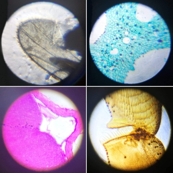 Little World Microscope Kit - Beginner Science Kit, Educational Toy with Prepared Slides 12 pcs, Magnification 1200X 400X 100X, Microscope for Kids, Birthday Gifts Little World Microscope Kit - Beginner Science Kit, Educational Toy with Prepared Slides 12 pcs, Magnification 1200X 400X 100X, Microscope for Kids, Birthday Gifts